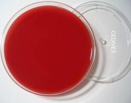 20071012102611-agar-sangre-ss.jpg